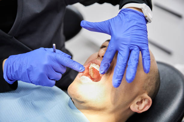 Best Emergency Dental Care for Broken or Chipped Teeth in Farr West, UT